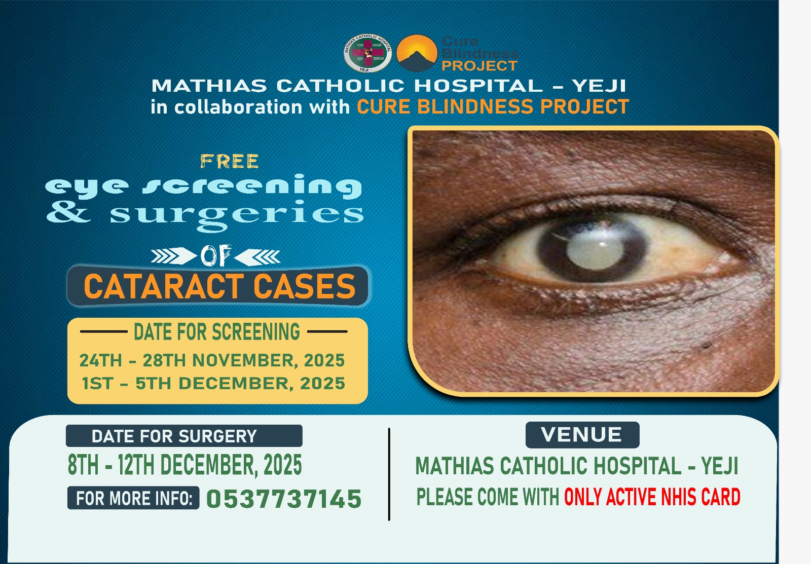 FREE EYE SCREENING & SURGERY FOR CATARACT CASES